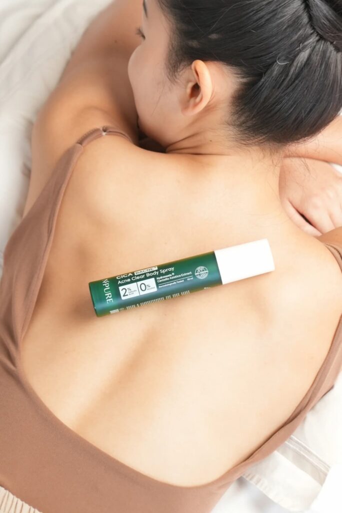 NPURE CICA ACNE CLEAR BODY SPRAY: Solusi Canggih untuk Kulit Bersih Tanpa Jerawat NPURE CICA ACNE CLEAR BODY SPRAY: Solusi Canggih untuk Kulit Bersih Tanpa Jerawat